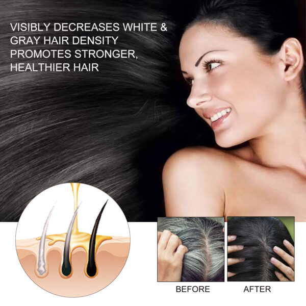 EELHOE Hair Dense Essence Hair Anti-hair Loss And Hair Fixation Nutrition - Image 7