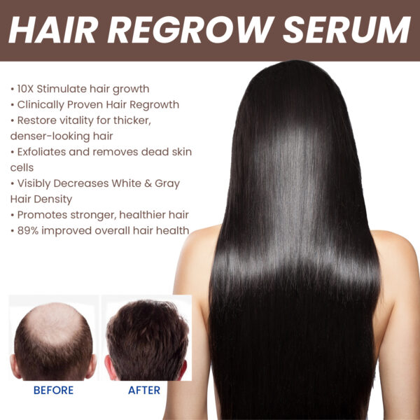 EELHOE Hair Dense Essence Hair Anti-hair Loss And Hair Fixation Nutrition - Image 4